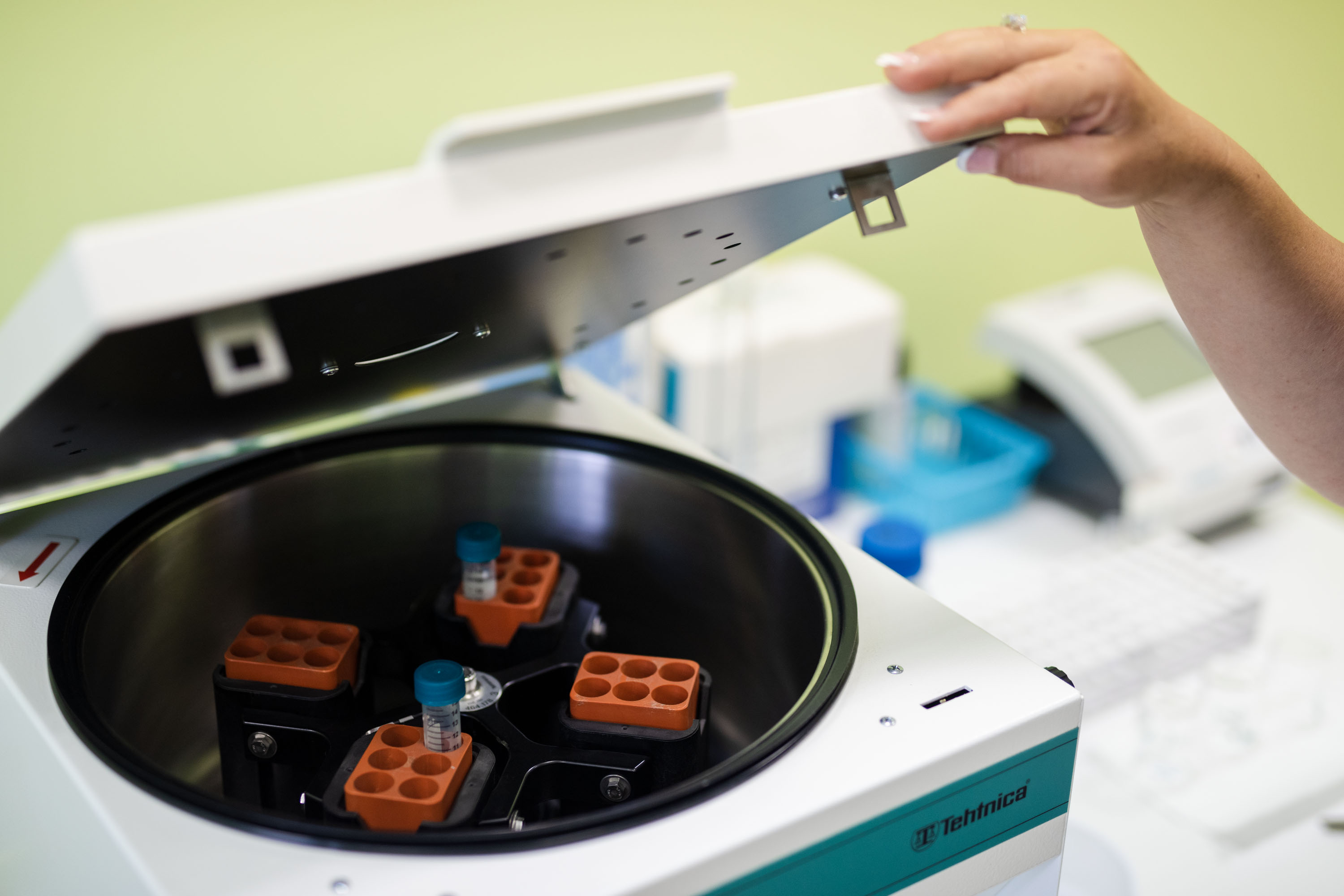 Pozor na problémy s tukmi – spôsobujú množstvo komplikácií, dá sa im však predísť