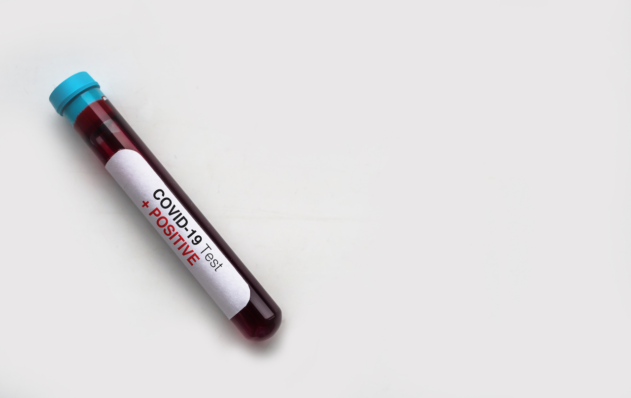 Radíme: Čo všetko kryje životné poistenie v súvislosti s koronavírusom?